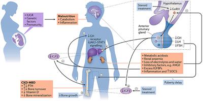 Strategies for Optimizing Growth in Children With Chronic Kidney Disease